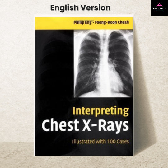 หนังสือไฟล์ [p.d.f] Interpreting Chest X-Rays Illustrated with 100 Cases